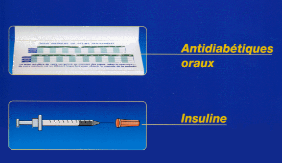 Diabète Type 2 - Traitement